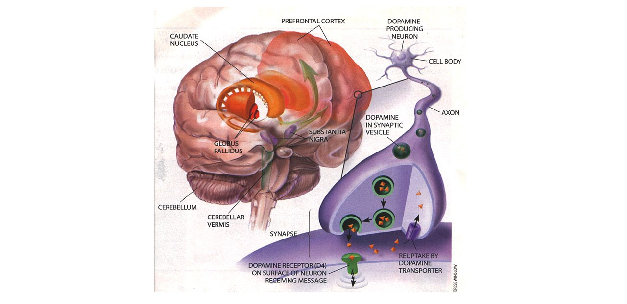 ADHD in Adults: Nature, Diagnosis, Impairments, and Long-Term Management -  by Russell A. Barkley, Ph.D., ABPP